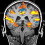 Quantitative Electrophysiology Icon